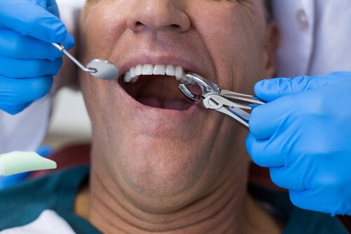 Breathtaking Can A Dental Bridge Be Removed And Recemented Photo Collection Breathtaking Can A Dental Bridge Be Removed And Recemented Photo Collection